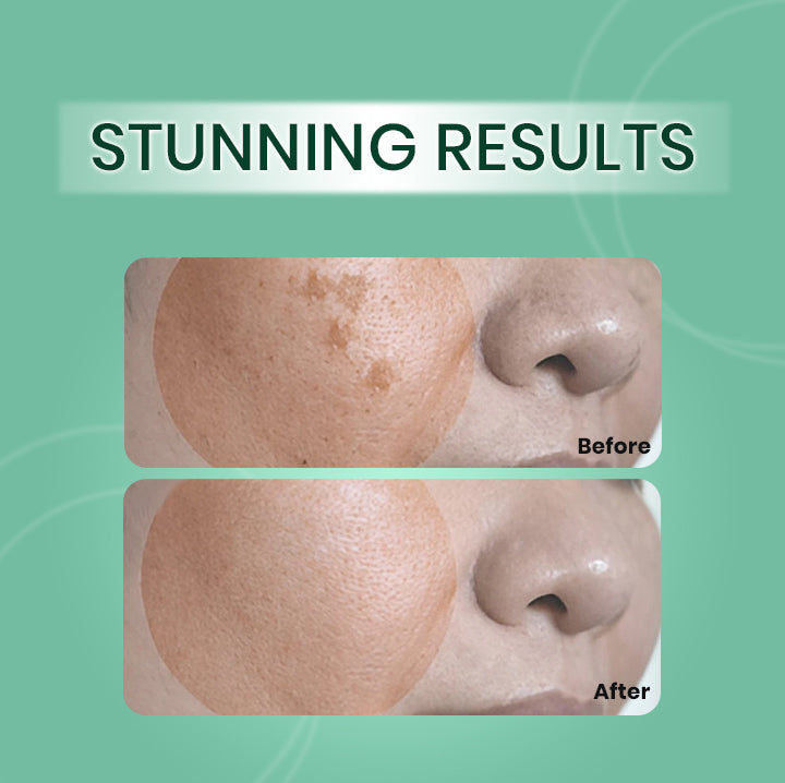 Dark Spot Corrector