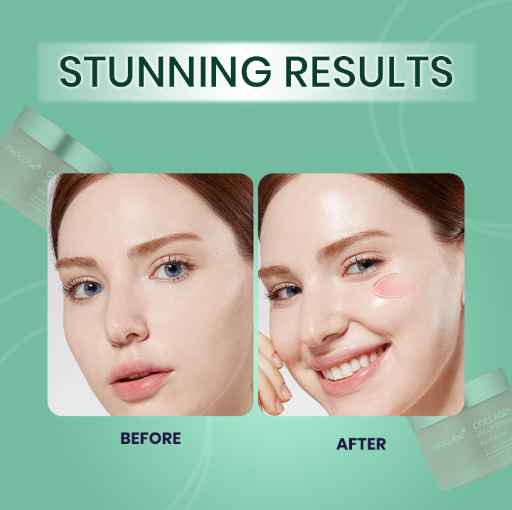 Collagen Niacinamide Jelly Cream