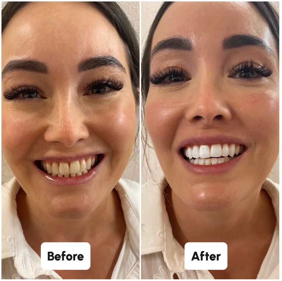 Blaire Teeth Whitening Powder (Buy 1, Get 1 Free)