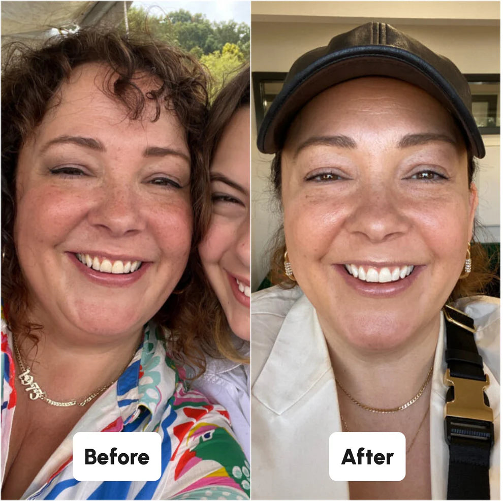 Blaire Teeth Whitening Powder (Buy 1, Get 1 Free)