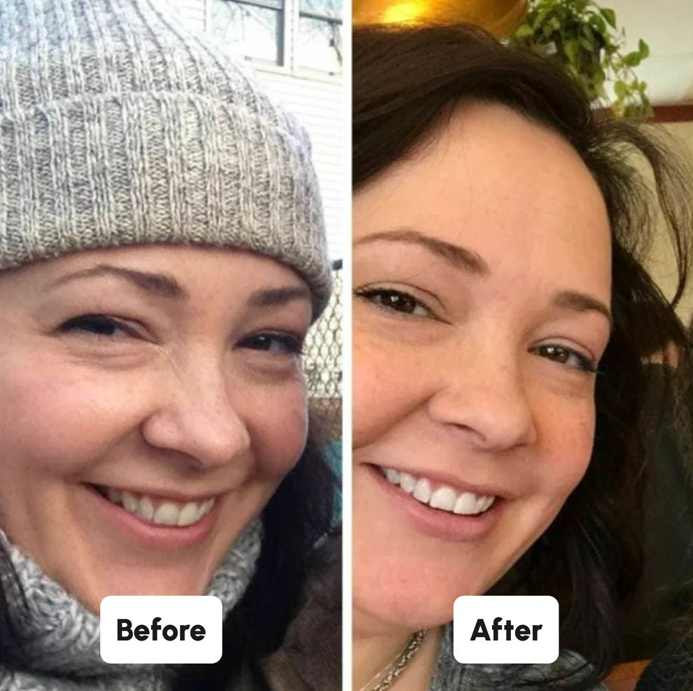Blaire Teeth Whitening Powder (Buy 1, Get 1 Free)