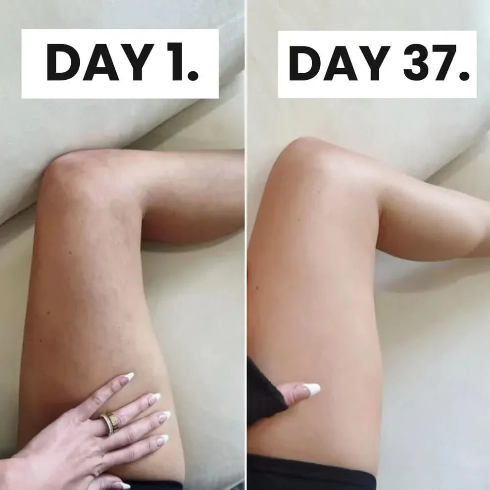 Blaire™ Cellulite Relief Kit