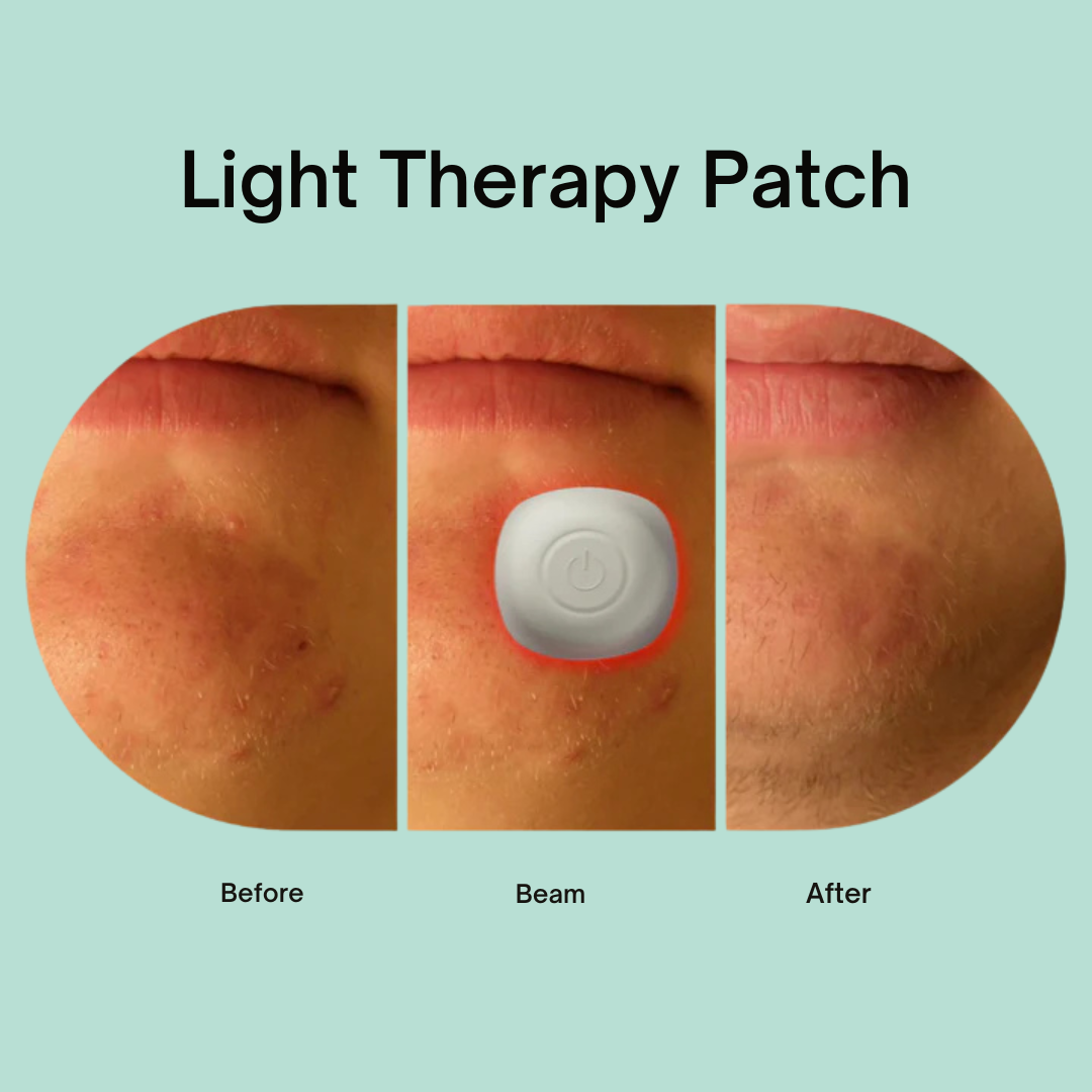 Acne Light Therapy Patch