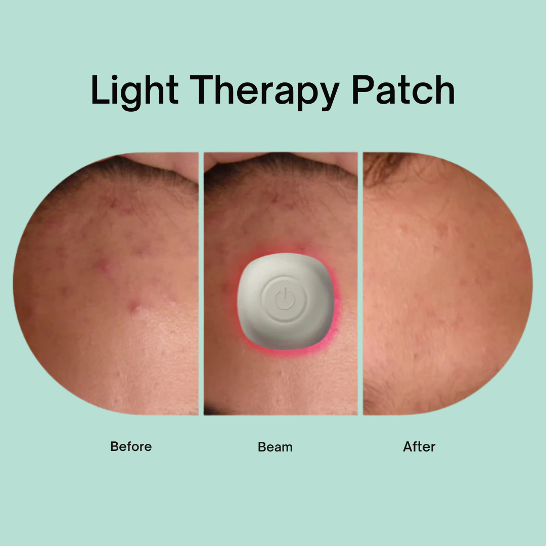 Acne Light Therapy Patch