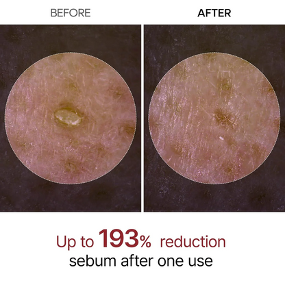 Pack of 2 | Dr. Melaxin™ Peel Shot Exfoliant Rice Ampoule