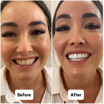 Blaire Teeth Whitening Powder (Buy 1, Get 1 Free)