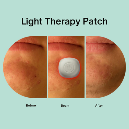 Acne Light Therapy Patch