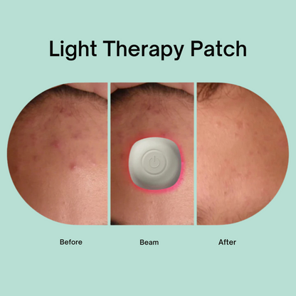 Acne Light Therapy Patch