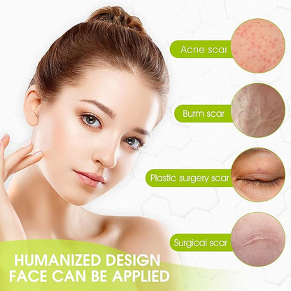 Silicone Scar Sheets