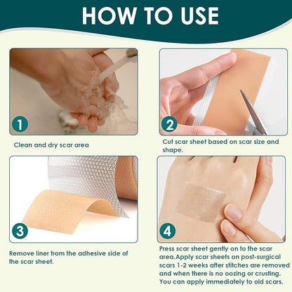 Silicone Scar Sheets