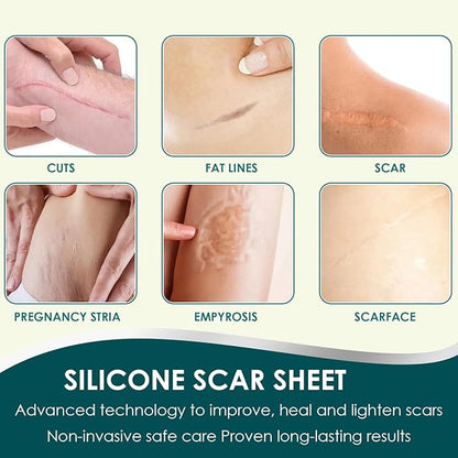 Silicone Scar Sheets